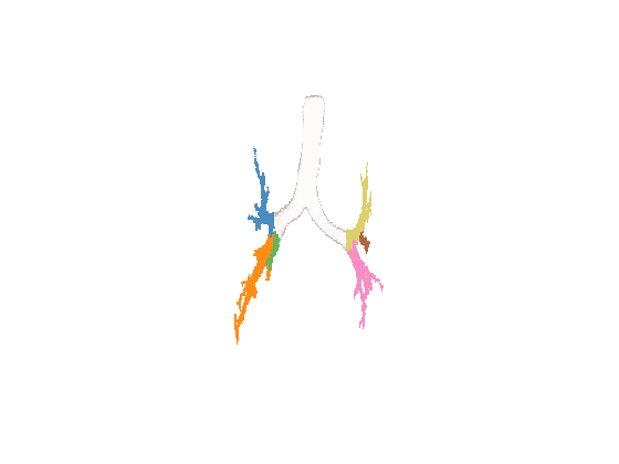 Example result of view3d for lobes